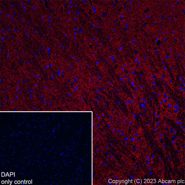 Immunohistochemistry (Frozen sections) - Alexa Fluor® 647 Anti-EAAT2 antibody [EPR19798] (AB313822), expandable thumbnail