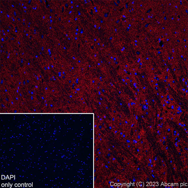 Immunohistochemistry (Frozen sections) - Alexa Fluor® 647 Anti-EAAT2 antibody [EPR19798] (AB313822)