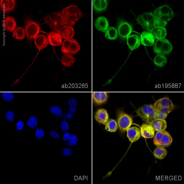 Immunocytochemistry/ Immunofluorescence - Alexa Fluor® 647 Anti-EB3 antibody [EPR11421(B)] (AB203265)