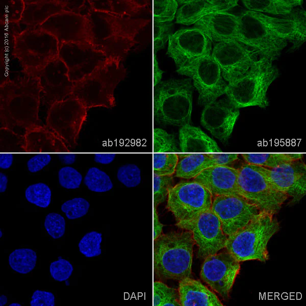 Alexa Fluor® 647 conjugated Anti-EGFR antibody [EP38Y] (ab192982