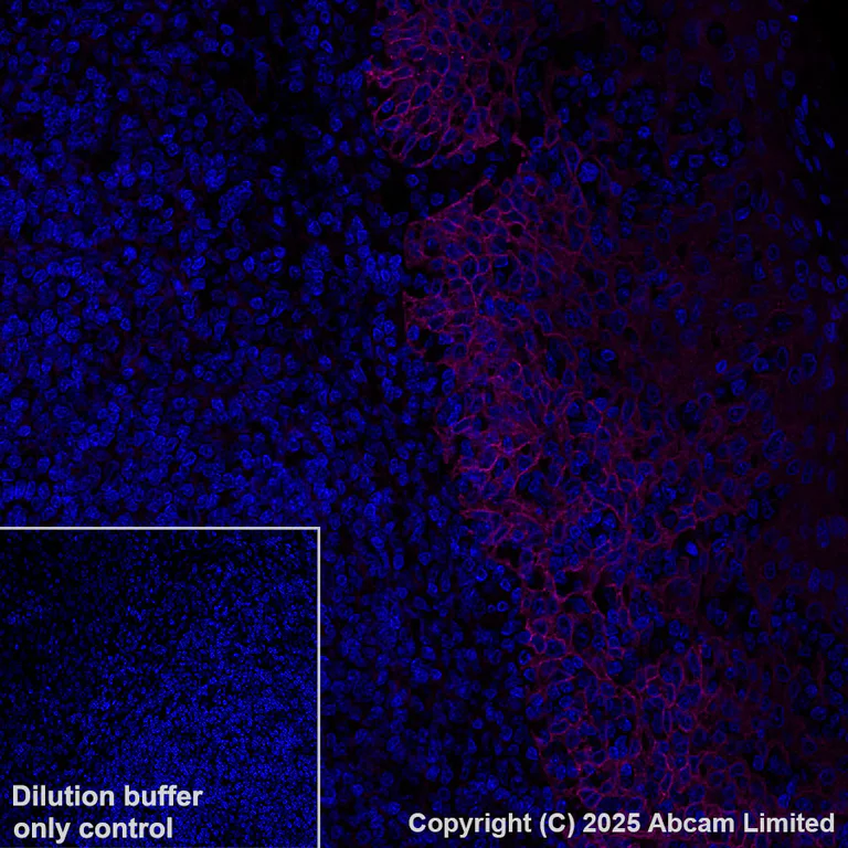 Immunohistochemistry (Formalin/PFA-fixed paraffin-embedded sections) - Alexa Fluor® 647 Anti-EGFR antibody [EP38Y] (AB192982)