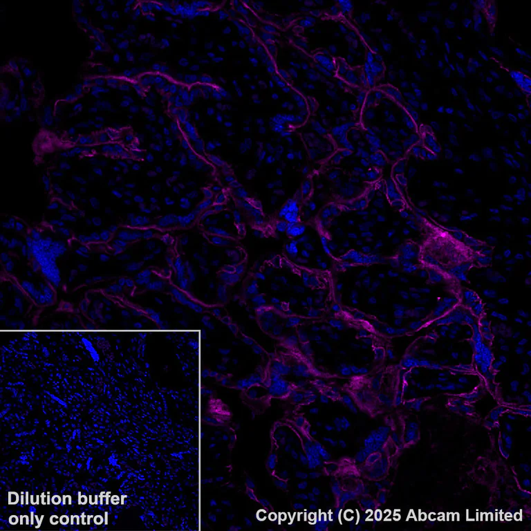 Immunohistochemistry (Formalin/PFA-fixed paraffin-embedded sections) - Alexa Fluor® 647 Anti-EGFR antibody [EP38Y] (AB192982)