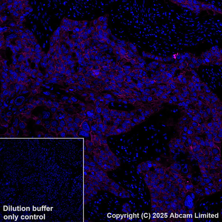 Immunohistochemistry (Formalin/PFA-fixed paraffin-embedded sections) - Alexa Fluor® 647 Anti-EGFR antibody [EP38Y] (AB192982)