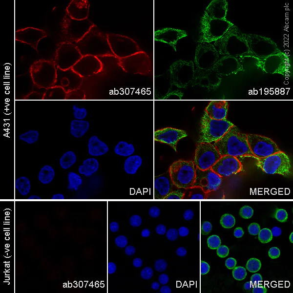 Immunocytochemistry/ Immunofluorescence - Alexa Fluor® 647 Anti-EGFR antibody [EPR39Y] (AB307465)