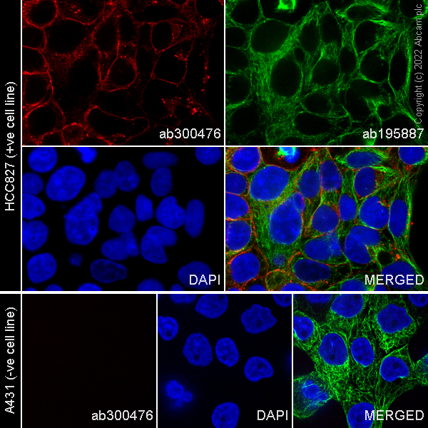 Immunocytochemistry/ Immunofluorescence - Alexa Fluor® 647 Anti-EGFR (deleted E746 + L747 + R748 + E749 + A750) antibody [SP111] (AB300476)