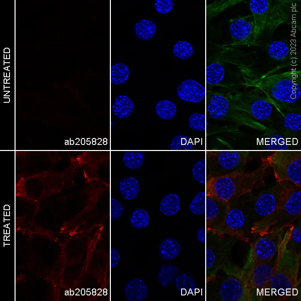 Immunocytochemistry/ Immunofluorescence - Alexa Fluor® 647 Anti-EGFR (phospho Y1068) antibody [EP774Y] (AB205828)