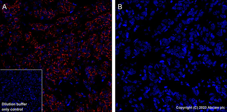 Immunohistochemistry (Formalin/PFA-fixed paraffin-embedded sections) - Alexa Fluor® 647 Anti-EGFR (phospho Y1068) antibody [EP774Y] (AB205828)