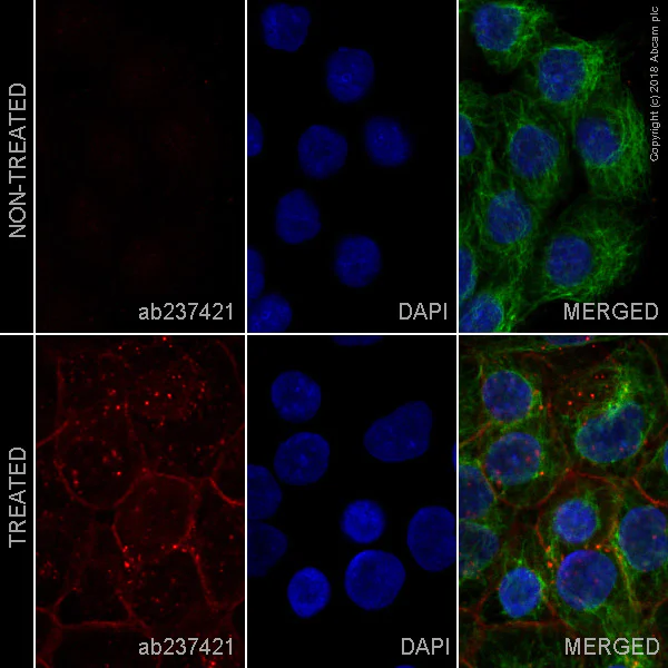 Immunocytochemistry/ Immunofluorescence - Alexa Fluor® 647 Anti-EGFR (phospho Y1068) antibody [Y38] (AB237421)
