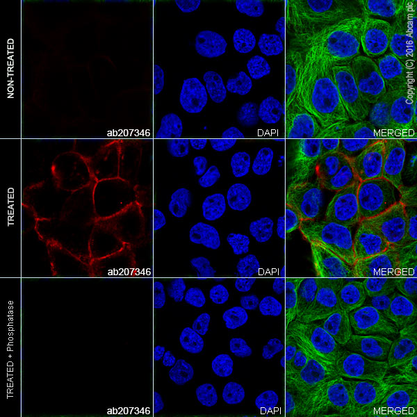 Immunocytochemistry/ Immunofluorescence - Alexa Fluor® 647 Anti-EGFR (phospho Y1173) antibody [E124] (AB207346)