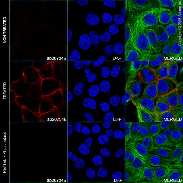 Immunocytochemistry/ Immunofluorescence - Alexa Fluor® 647 Anti-EGFR (phospho Y1173) antibody [E124] (AB207346)