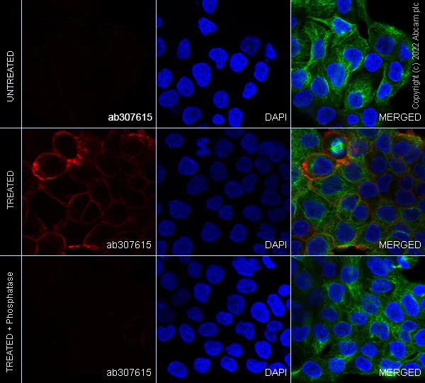 Immunocytochemistry/ Immunofluorescence - Alexa Fluor® 647 Anti-EGFR (phospho Y845) antibody [EPR2149Y] (AB307615)