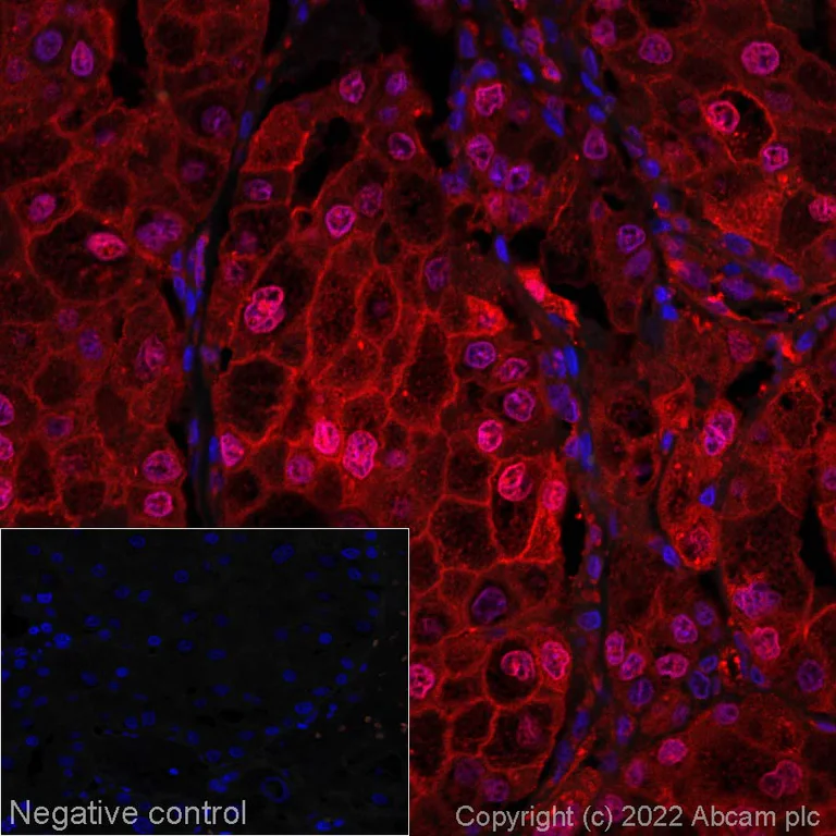 Immunohistochemistry (Formalin/PFA-fixed paraffin-embedded sections) - Alexa Fluor® 647 Anti-ENO1 antibody [EPR19758] (AB303584)