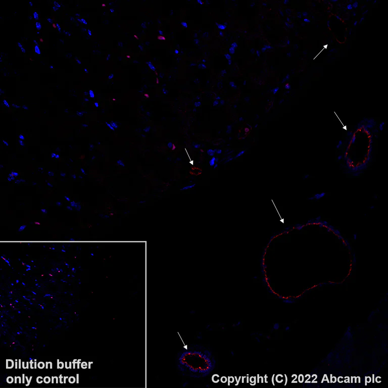 Immunohistochemistry (Formalin/PFA-fixed paraffin-embedded sections) - Alexa Fluor® 647 Anti-eNOS antibody [EPR26335-79] (AB307339)