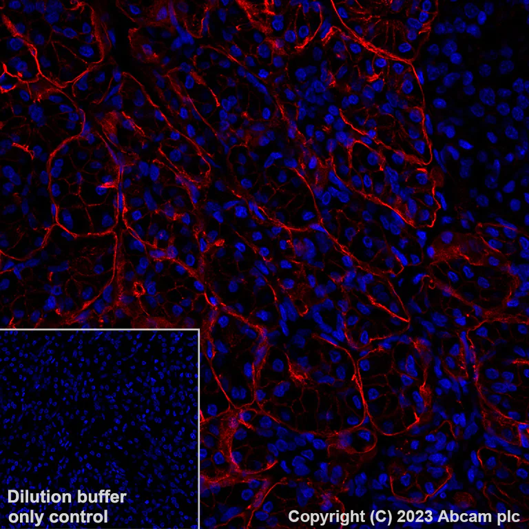 Immunohistochemistry (Formalin/PFA-fixed paraffin-embedded sections) - Alexa Fluor® 647 Anti-ENPP1/PC1 antibody [EPR22262-22] (AB315846)