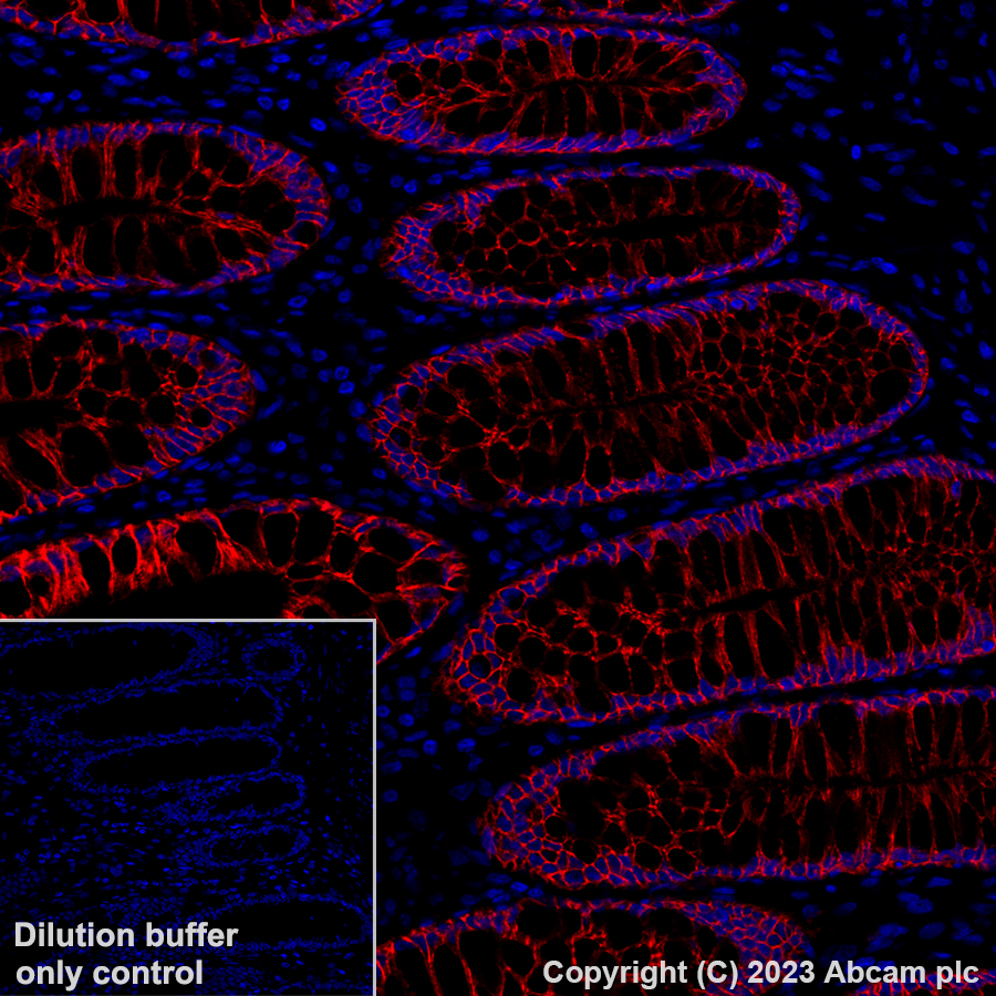 Alexa Fluor® 647 Anti-EpCAM antibody [EPR20532-222] (ab313669) | Abcam