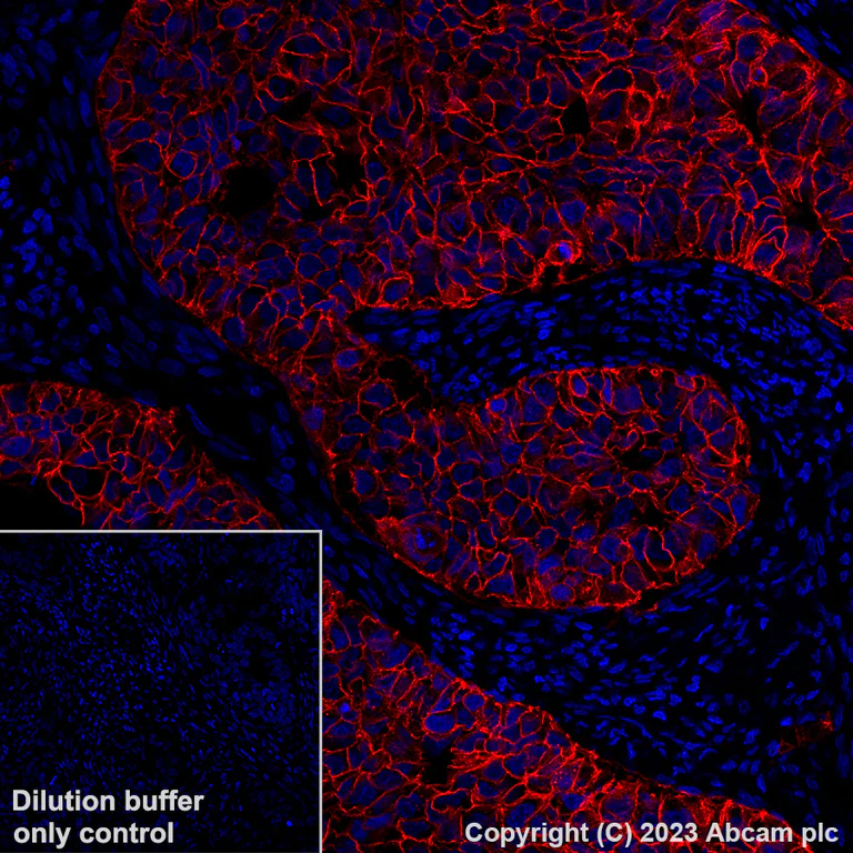 Immunohistochemistry (Formalin/PFA-fixed paraffin-embedded sections) - Alexa Fluor® 647 Anti-EpCAM antibody [EPR20532-222] (AB313669)