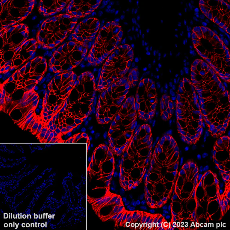 Immunohistochemistry (Formalin/PFA-fixed paraffin-embedded sections) - Alexa Fluor® 647 Anti-EpCAM antibody [EPR20532-222] (AB313669)