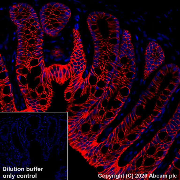 Immunohistochemistry (Formalin/PFA-fixed paraffin-embedded sections) - Alexa Fluor® 647 Anti-EpCAM antibody [EPR20532-222] (AB313669)