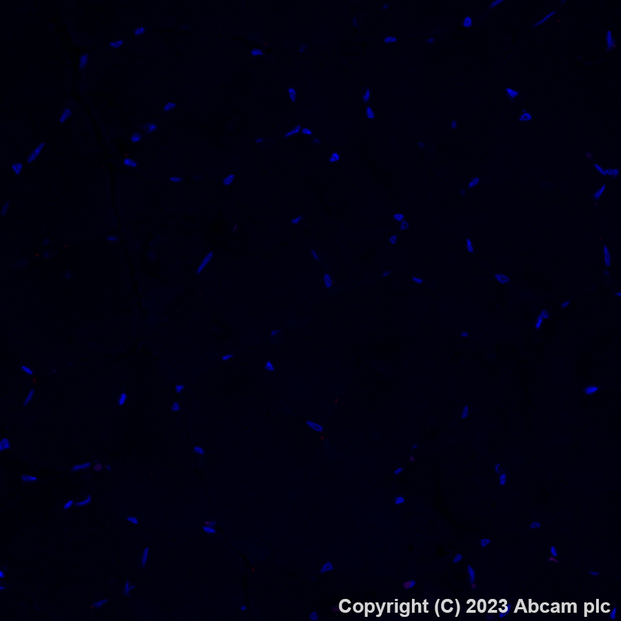 Immunohistochemistry (Formalin/PFA-fixed paraffin-embedded sections) - Alexa Fluor® 647 Anti-EpCAM antibody [EPR20532-222] (AB313669)