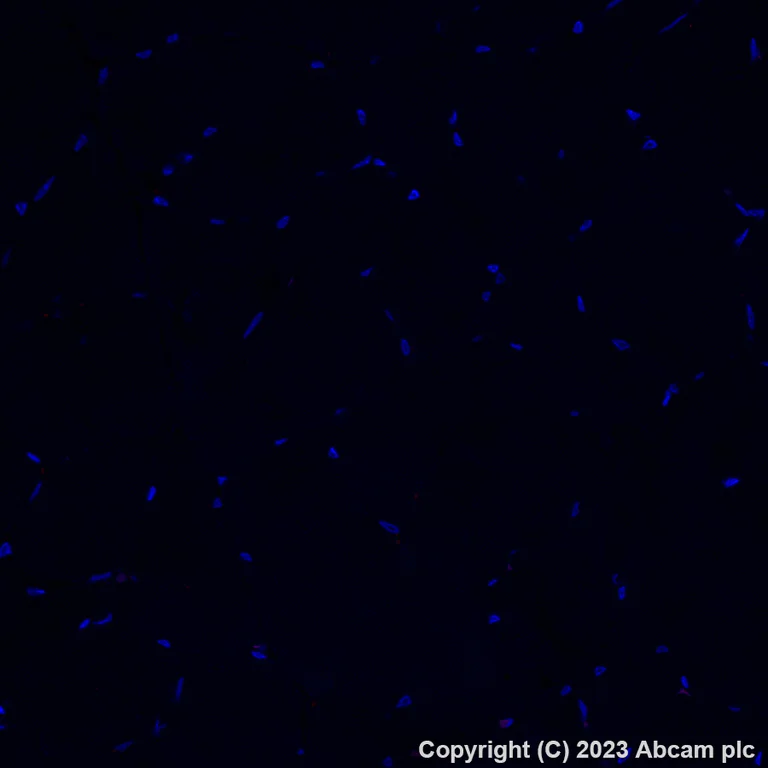 Immunohistochemistry (Formalin/PFA-fixed paraffin-embedded sections) - Alexa Fluor® 647 Anti-EpCAM antibody [EPR20532-222] (AB313669)