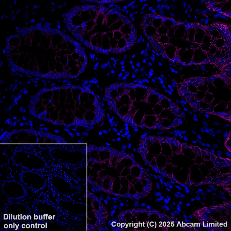 Immunohistochemistry (Formalin/PFA-fixed paraffin-embedded sections) - Alexa Fluor® 647 Anti-EpCAM antibody [EPR20532-225] (AB237396)