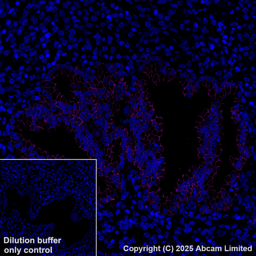 Immunohistochemistry (Formalin/PFA-fixed paraffin-embedded sections) - Alexa Fluor® 647 Anti-EpCAM antibody [EPR20532-225] (AB237396)