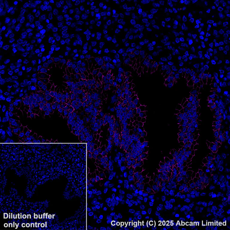 Immunohistochemistry (Formalin/PFA-fixed paraffin-embedded sections) - Alexa Fluor® 647 Anti-EpCAM antibody [EPR20532-225] (AB237396)