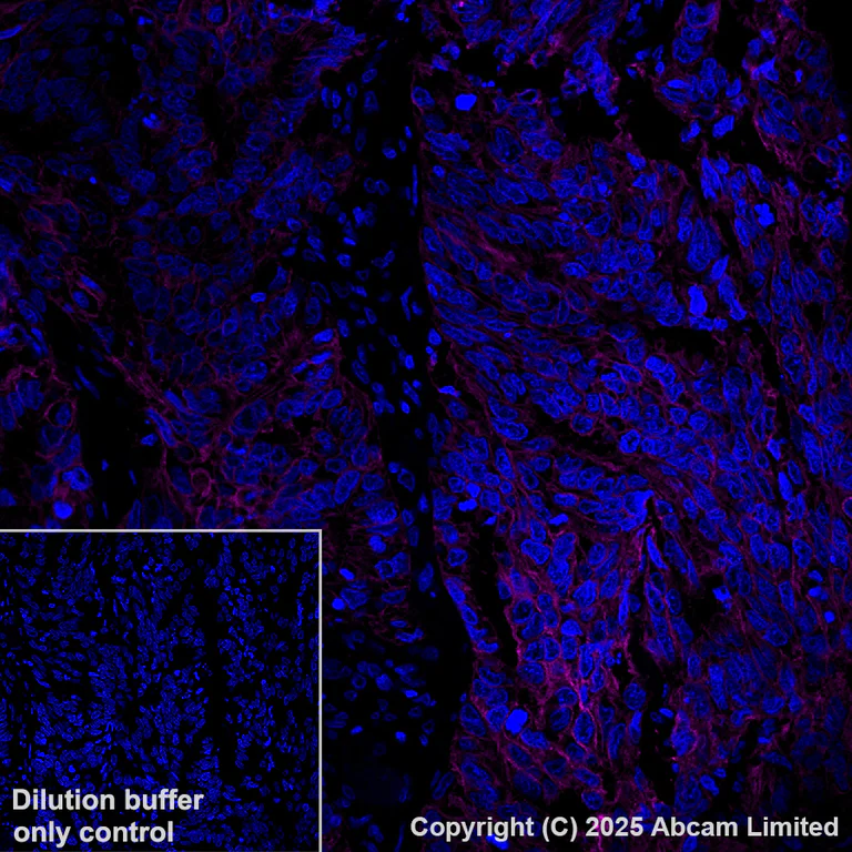 Immunohistochemistry (Formalin/PFA-fixed paraffin-embedded sections) - Alexa Fluor® 647 Anti-EpCAM antibody [EPR20532-225] (AB237396)