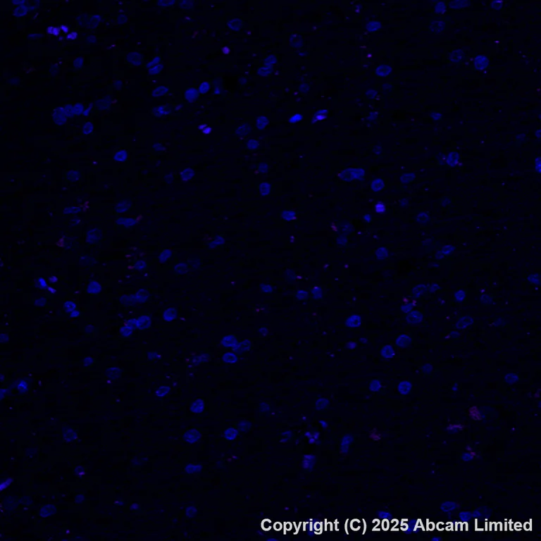 Immunohistochemistry (Formalin/PFA-fixed paraffin-embedded sections) - Alexa Fluor® 647 Anti-EpCAM antibody [EPR20532-225] (AB237396)
