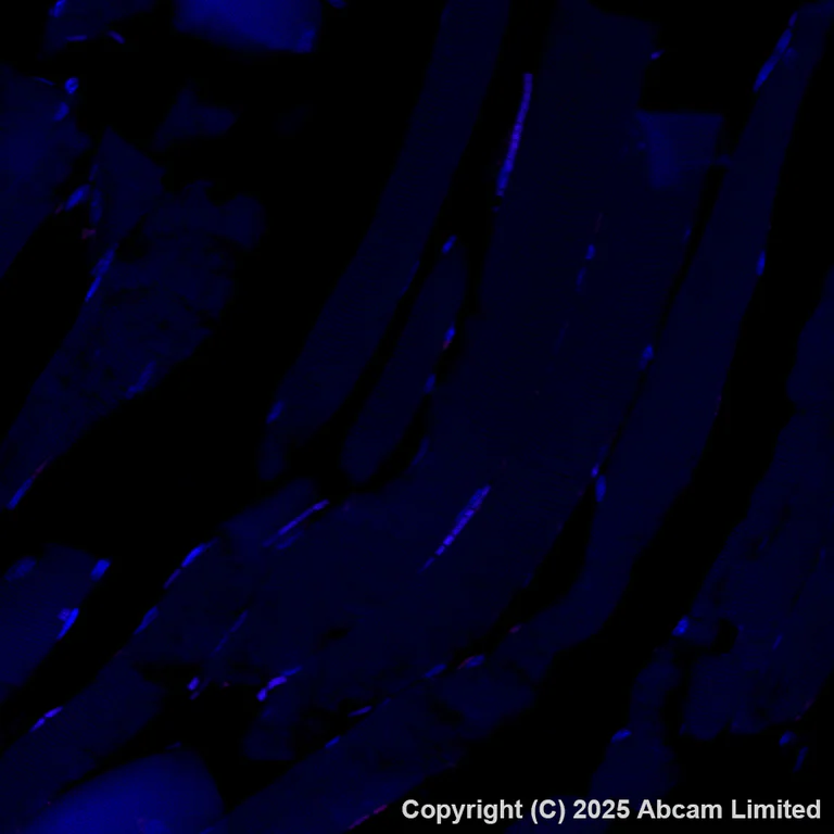 Immunohistochemistry (Formalin/PFA-fixed paraffin-embedded sections) - Alexa Fluor® 647 Anti-EpCAM antibody [EPR20532-225] (AB237396)