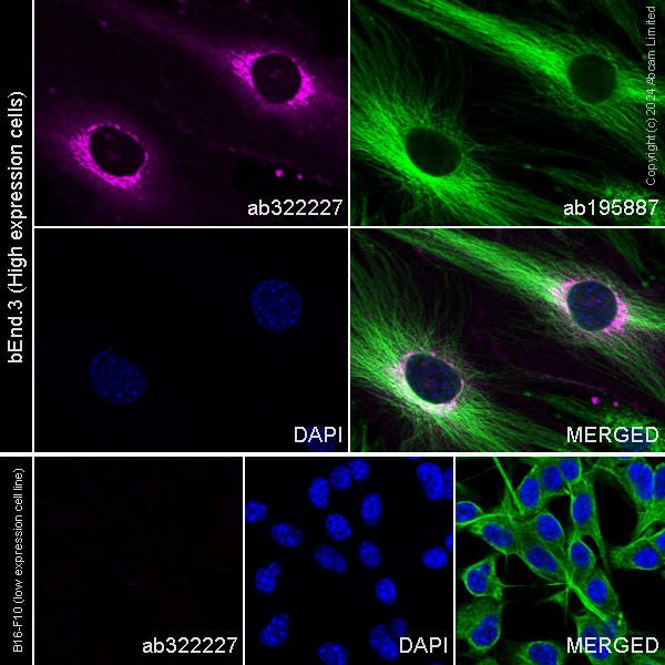 Immunocytochemistry/ Immunofluorescence - Alexa Fluor® 647 Anti-EPCR/CD201 antibody [EPR26267-19] (AB322227), expandable thumbnail