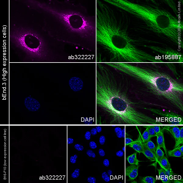 Immunocytochemistry/ Immunofluorescence - Alexa Fluor® 647 Anti-EPCR/CD201 antibody [EPR26267-19] (AB322227)