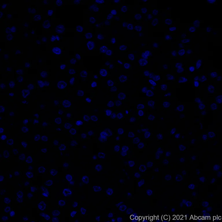 Immunohistochemistry (Formalin/PFA-fixed paraffin-embedded sections) - Alexa Fluor® 647 Anti-ErbB2 / HER2 antibody [EP1045Y] (AB281578)