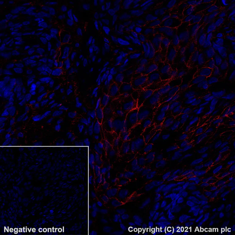Immunohistochemistry (Formalin/PFA-fixed paraffin-embedded sections) - Alexa Fluor® 647 Anti-ErbB2 / HER2 antibody [EP1045Y] (AB281578)