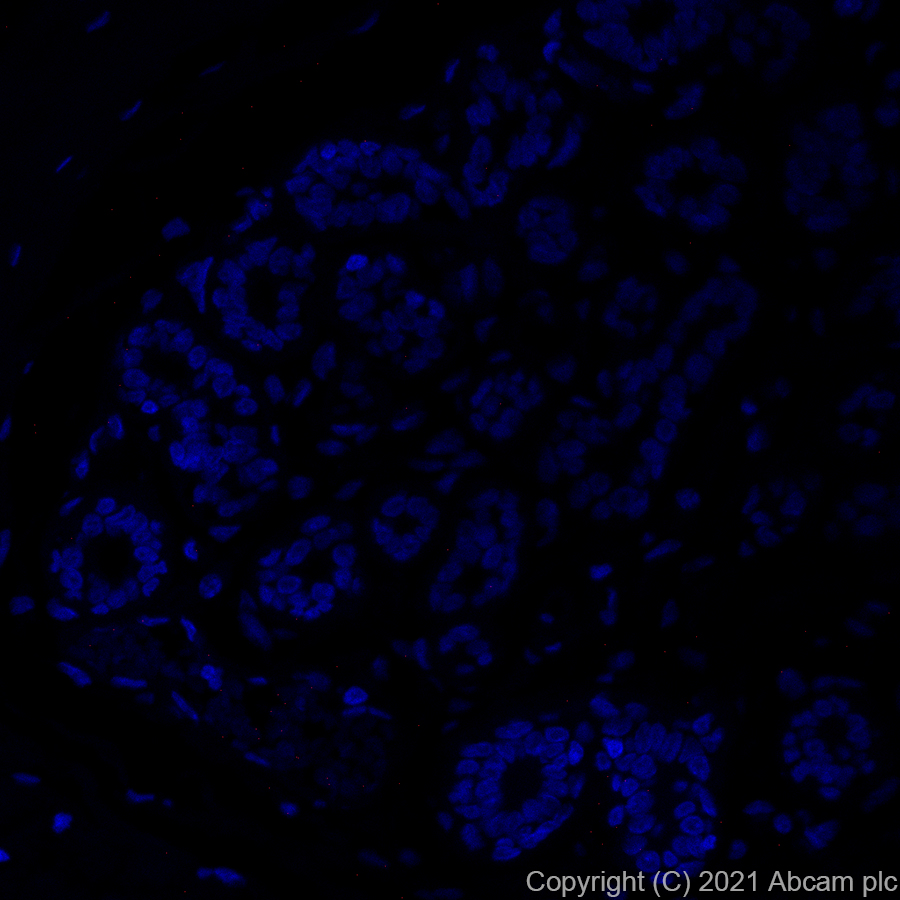 Anti-ErbB2 / HER2 Alexa Fluor® 647 antibody [EP1045Y] (ab281578