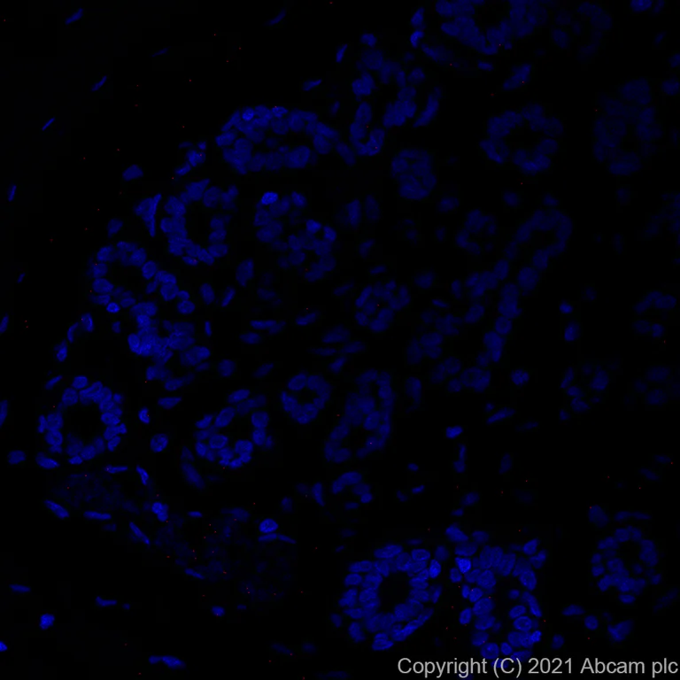 Immunohistochemistry (Formalin/PFA-fixed paraffin-embedded sections) - Alexa Fluor® 647 Anti-ErbB2 / HER2 antibody [EP1045Y] (AB281578)