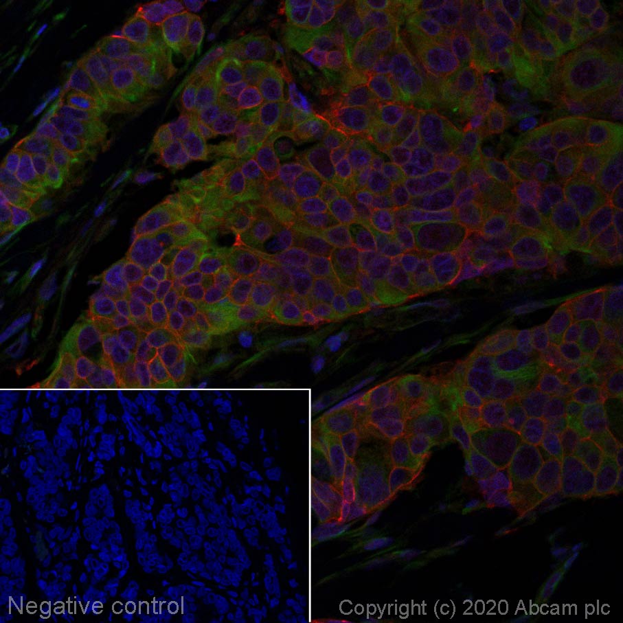 Immunohistochemistry (Formalin/PFA-fixed paraffin-embedded sections) - Alexa Fluor® 647 Anti-ErbB2 / HER2 antibody [SP3] (AB270191), expandable thumbnail
