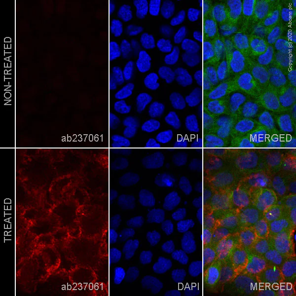 Immunocytochemistry/ Immunofluorescence - Alexa Fluor® 647 Anti-ErbB2 / HER2 (phospho Y877) antibody [EP2324Y] (AB237061)