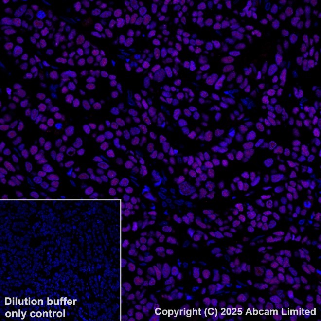 Immunohistochemistry (Formalin/PFA-fixed paraffin-embedded sections) - Alexa Fluor® 647 Anti-Estrogen Receptor alpha antibody [EPR4097] (AB205851)