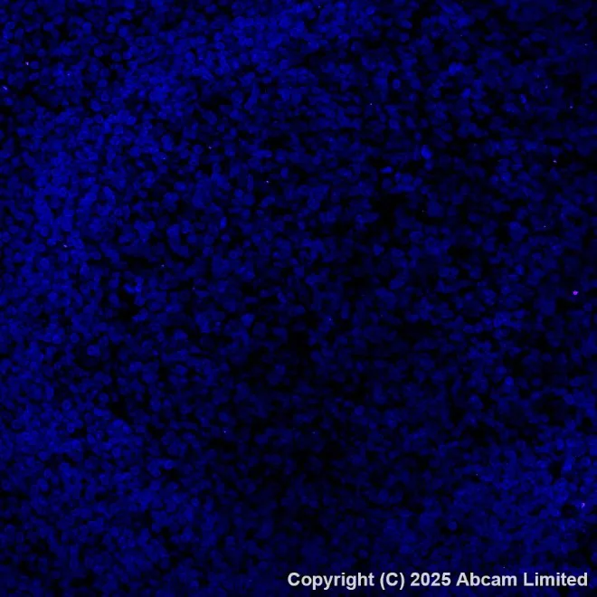 Immunohistochemistry (Formalin/PFA-fixed paraffin-embedded sections) - Alexa Fluor® 647 Anti-Estrogen Receptor alpha antibody [EPR4097] (AB205851)