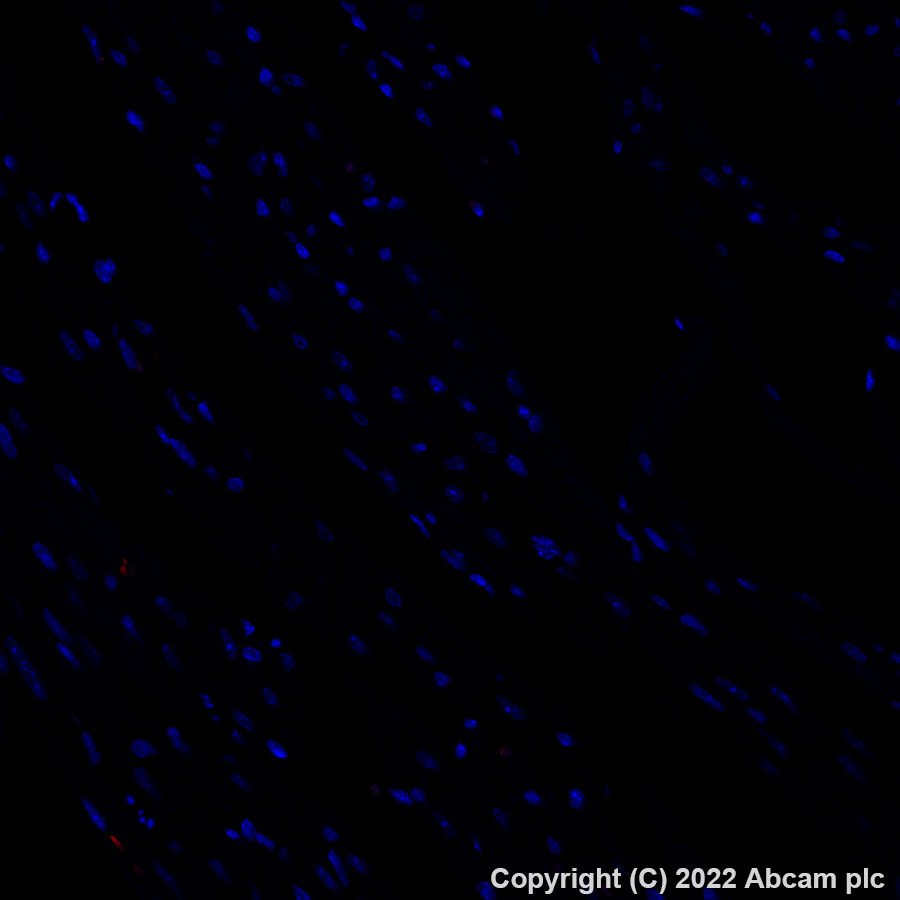 Immunohistochemistry (Formalin/PFA-fixed paraffin-embedded sections) - Alexa Fluor® 647 Anti-F4/80 antibody [EPR26545-166] (AB307470), expandable thumbnail