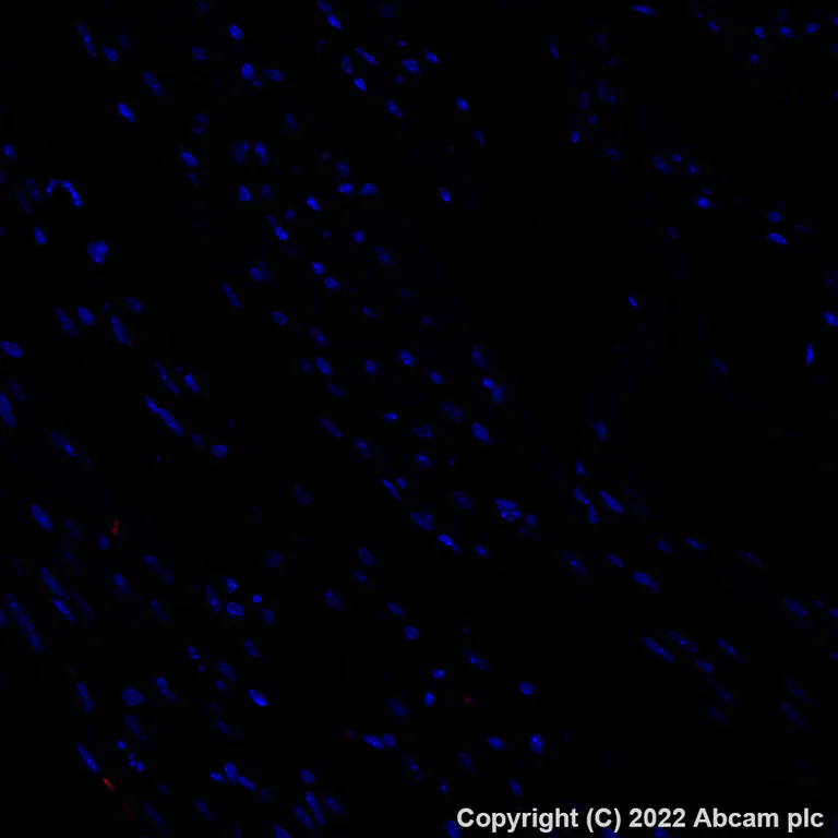 Immunohistochemistry (Formalin/PFA-fixed paraffin-embedded sections) - Alexa Fluor® 647 Anti-F4/80 antibody [EPR26545-166] (AB307470)