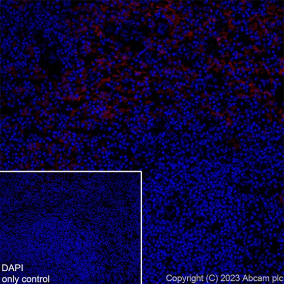 Immunohistochemistry (Frozen sections) - Alexa Fluor® 647 Anti-F4/80 antibody [EPR26545-166] (AB307470), expandable thumbnail