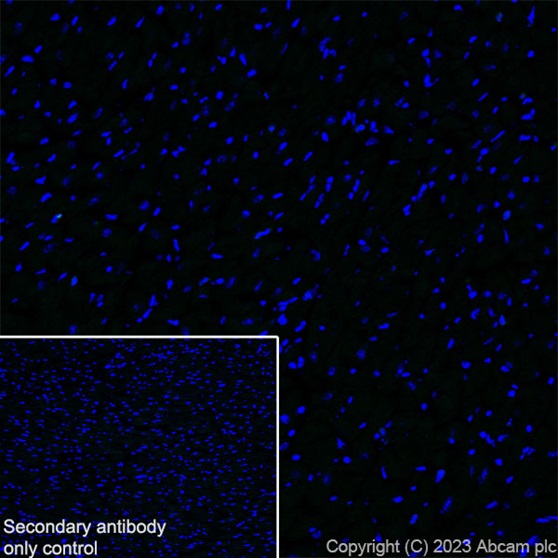 Immunohistochemistry (Frozen sections) - Alexa Fluor® 647 Anti-F4/80 antibody [EPR26545-166] (AB307470), expandable thumbnail