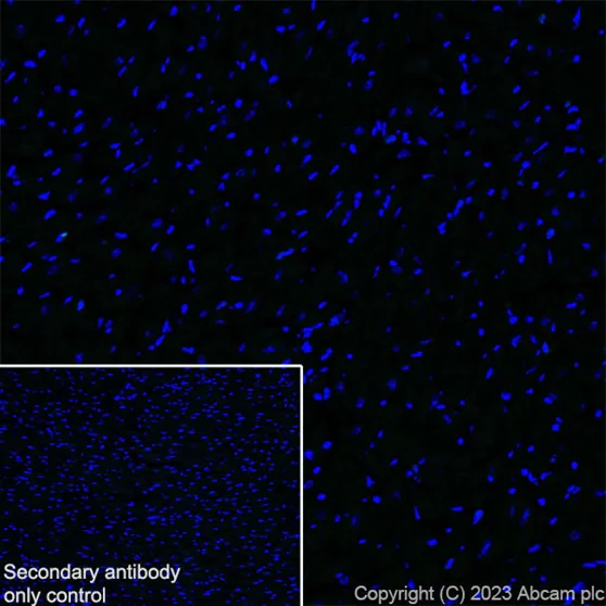 Élisaページ Alexa Fluor® 647 conjugated Anti-F4/80 antibody [EPR26545
