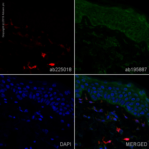 Immunohistochemistry (Formalin/PFA-fixed paraffin-embedded sections) - Alexa Fluor® 647 Anti-Factor XIIIa antibody [EP3372] (AB225018), expandable thumbnail
