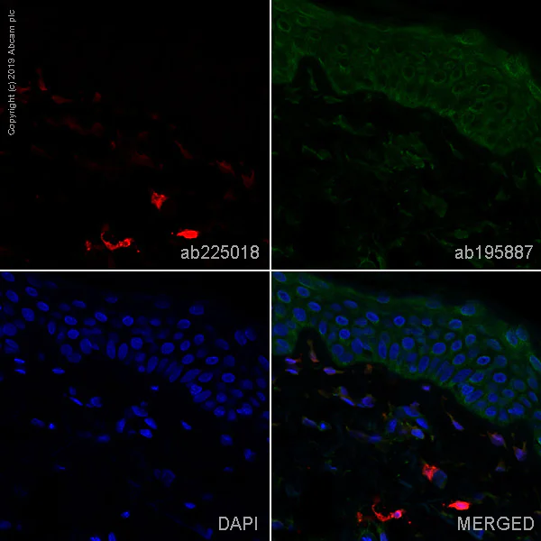 Immunohistochemistry (Formalin/PFA-fixed paraffin-embedded sections) - Alexa Fluor® 647 Anti-Factor XIIIa antibody [EP3372] (AB225018)