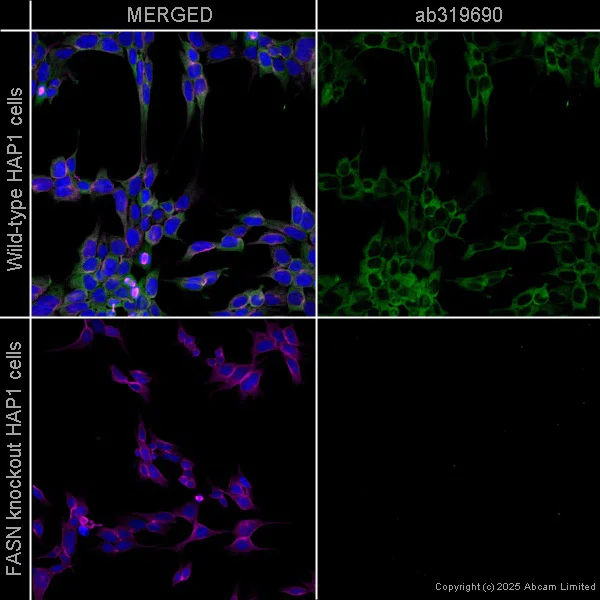 Immunocytochemistry/ Immunofluorescence - Alexa Fluor® 647 Anti-Fatty Acid Synthase antibody [EPR7466] (AB319690)