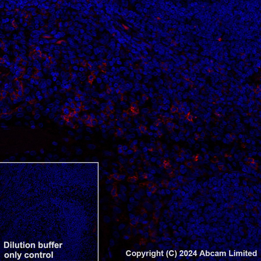Immunohistochemistry (Formalin/PFA-fixed paraffin-embedded sections) - Alexa Fluor® 647 Anti-FCRL4 antibody [EPR21961] (AB320114), expandable thumbnail