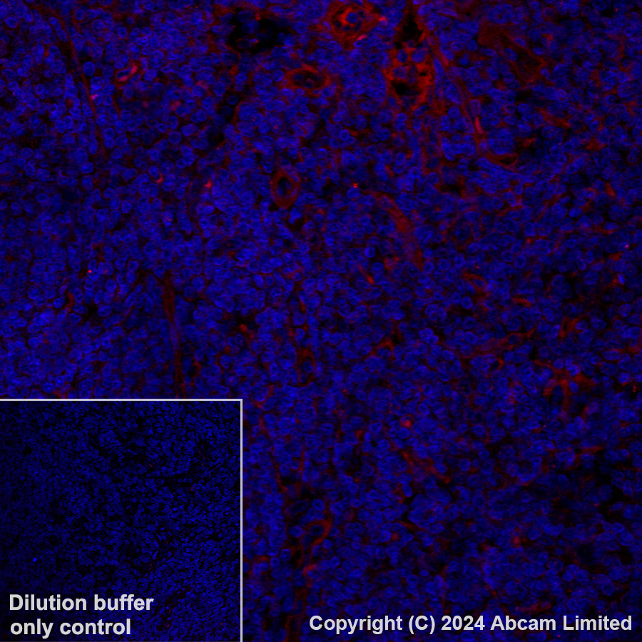 Immunohistochemistry (Formalin/PFA-fixed paraffin-embedded sections) - Alexa Fluor® 647 Anti-FCRL4 antibody [EPR21961] (AB320114), expandable thumbnail
